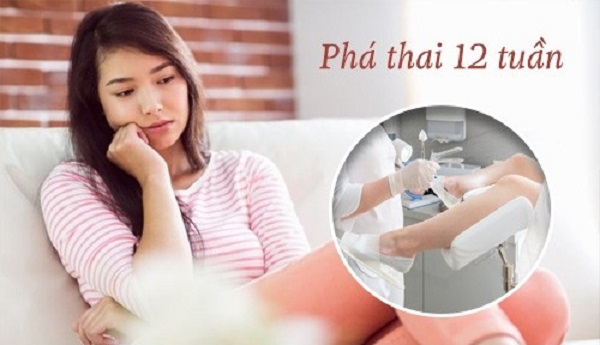 Phá thai 12 tuần có an toàn không? Chia sẻ từ chuyên gia Sản phụ khoa