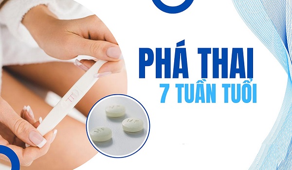 Phá thai 7 tuần bằng cách nào an toàn, không đau, hồi phục nhanh?